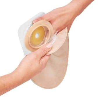 2-delig stomasysteem