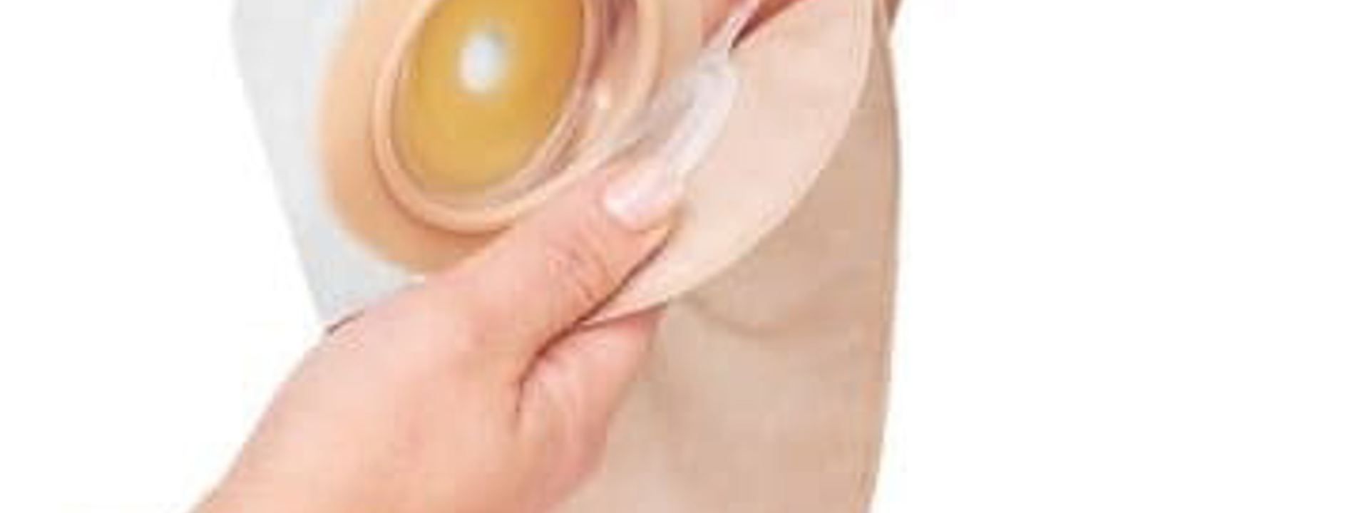 2-delig stomasysteem